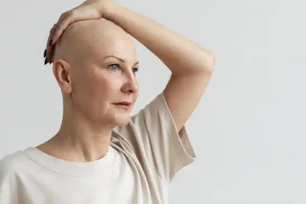 Femme cancer de la peau - Freepik