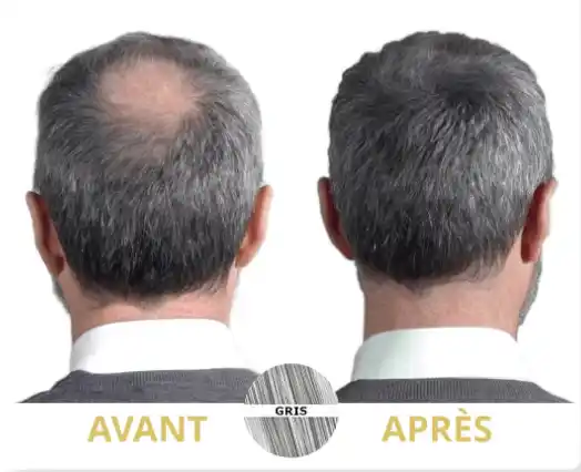 Avant-après poudre densifiante homme