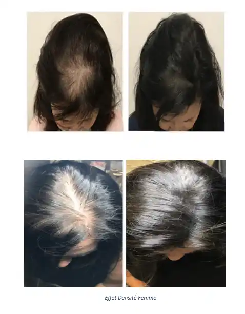 Trichopigmentation Effet densité femmes