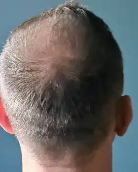 B&eacute;ta-testeur Homme Juste Paris- Univhair