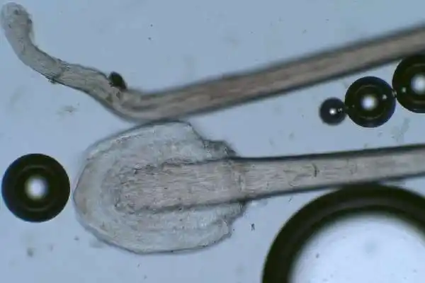 Bulbe sain versus bulbe affaibli- Univ'Hair